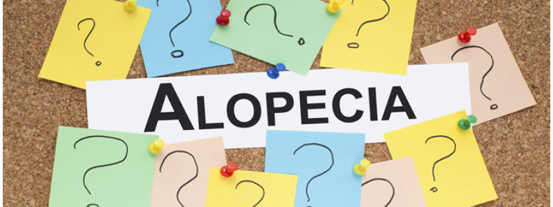 Meet Ben: My Real Life Alopecia Story