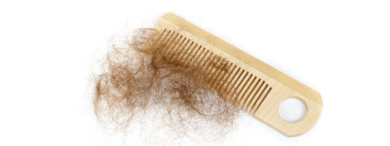 My Alopeica experience